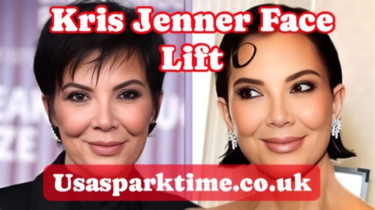 Kris Jenner Face Lift